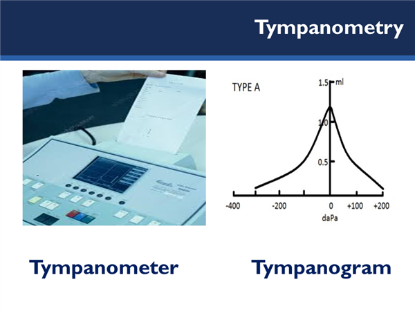 Picture of a tympanometer and tympanogram reading