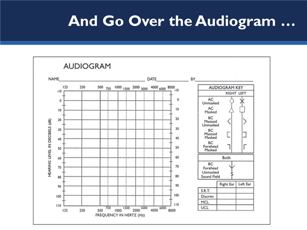 Picture of audiogram readout