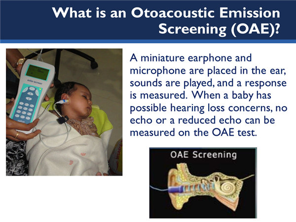 Picture of infant getting hearing tested.